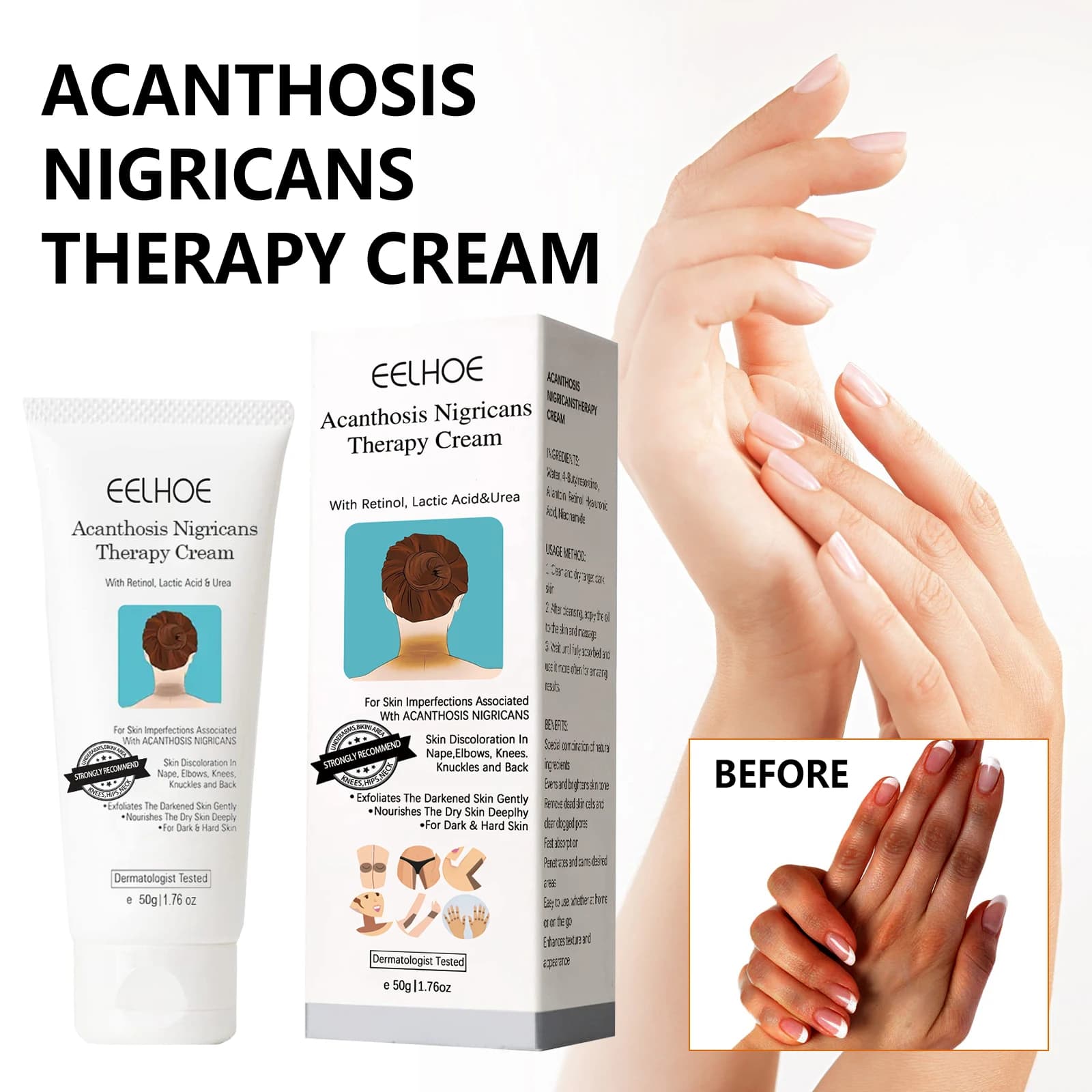 EELHOE Crema riparatrice per la pelle spinosa nera Riparazione ascellare braccio articolazione del ginocchio Crema idratante bianca nera per la cura del corpo