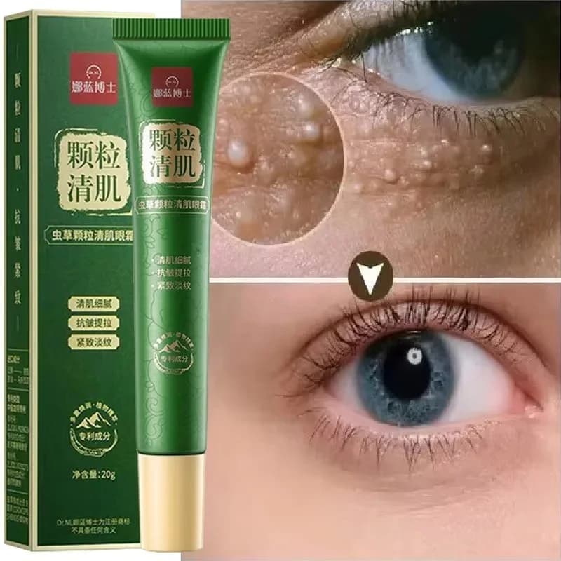 Anti-Grassus Eye Contour Cream, Anti-Gonfiore, Anti-Inflammation, Reduces Occhiaie and Bags, Watch the Wings, Hydrating for Eye Care