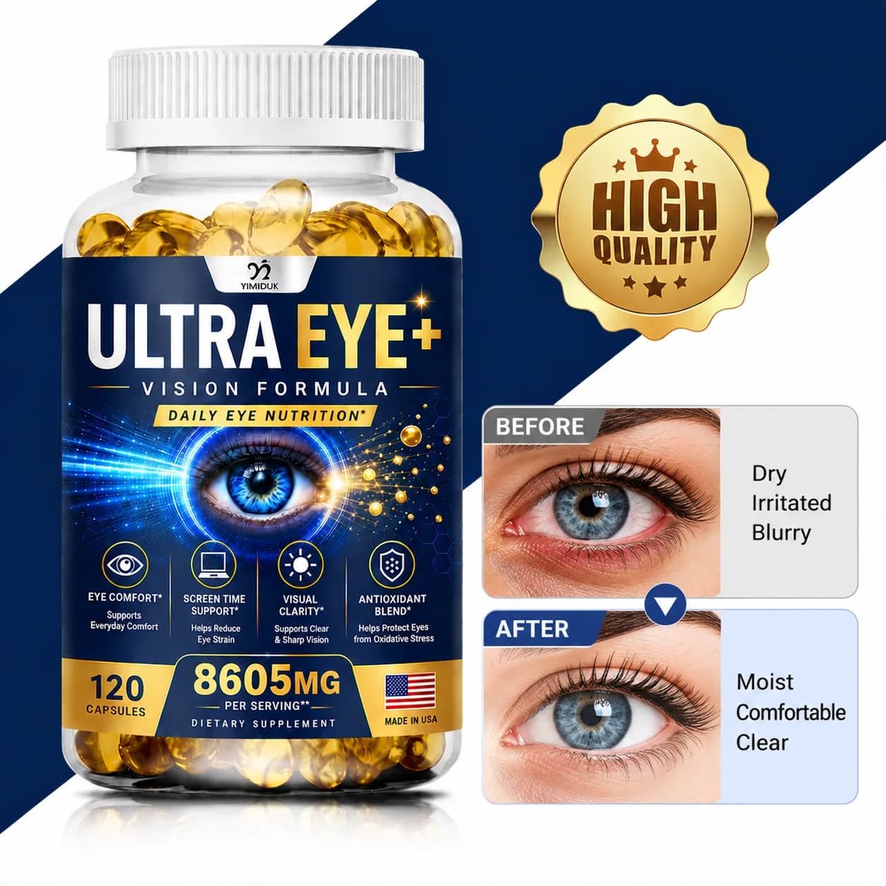 Ultra Eye Support Supplements, with Lutein, Zeaxanthin, for Macular Health, Dry Eyes, Supports Eye Strain, Stress, Night Vision