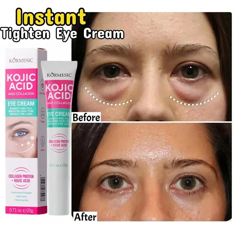 Anti-Borse Instant Cream Under Collagen Eyes, Anti-Corporate, Rassodant, Careful Subtle Lines, Anti-Occhiaie, Anti-Gonfiore, Illuminant for Eye Care