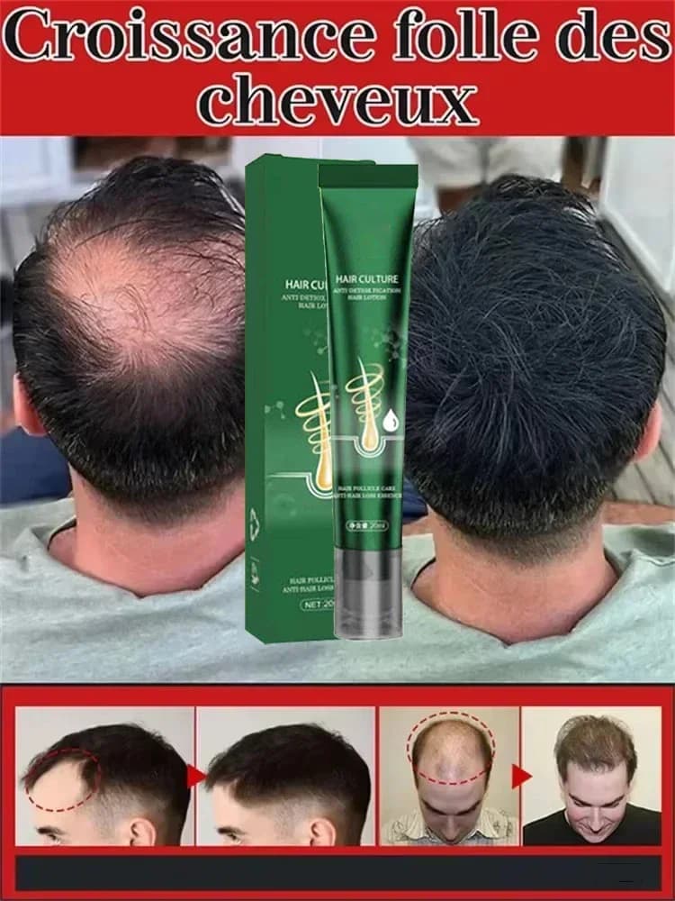 2025 Biotina Olio per la crescita rapida dei capelli Siero per la ricrescita dei capelli Trattamento per l'assottigliamento dei capelli Liquido per la crescita dei capelli Anti-perdita di capelli per donne e uomini