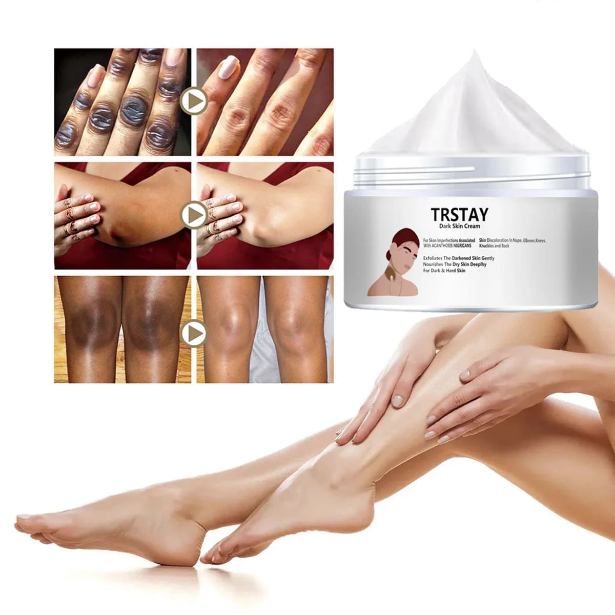 TRSTAY Dark Skin Cream Body Nourishing Whitening Lotion for Dull Rough Skin Deep Moisture Joints Backs Suitable
