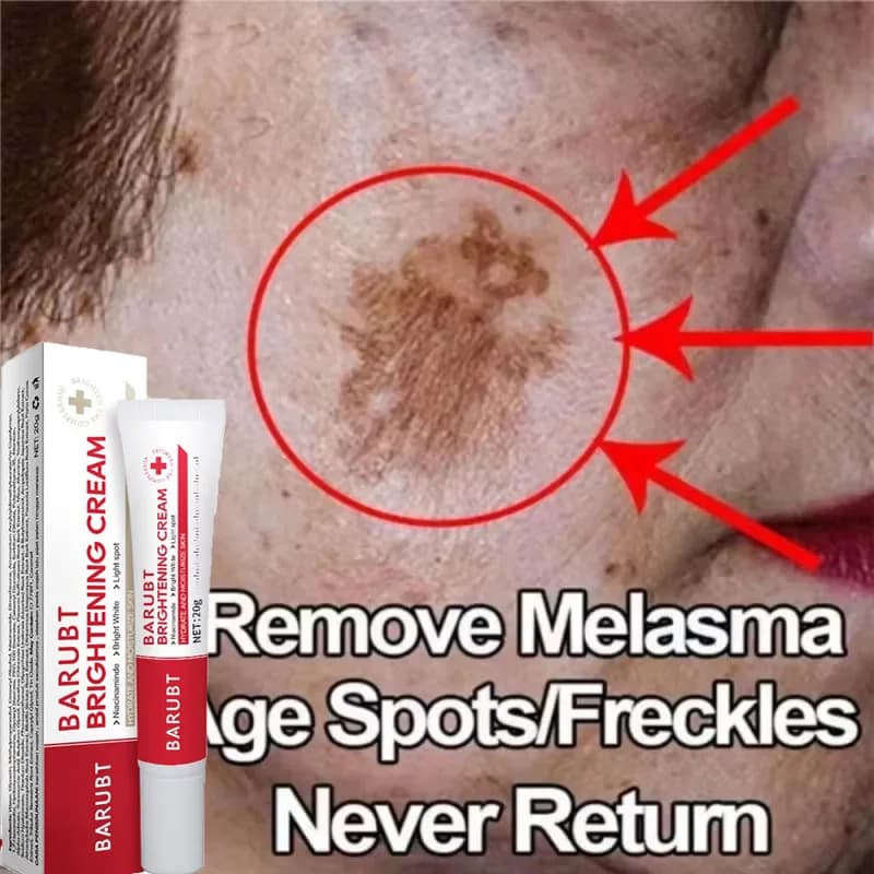 Powerful Whitening Cream Remove-Macchie, Quickly Light Skin, Eliminate Melanine, Pigmentation, Melasma and Macchie Scure, Korean Skin Care