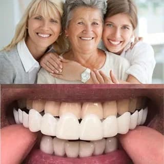 2026 Temporary Dentali Faccettes Without Colla, Whitening, Natural and Confortevoli, Perfect for Daily Life and Social Events ck848