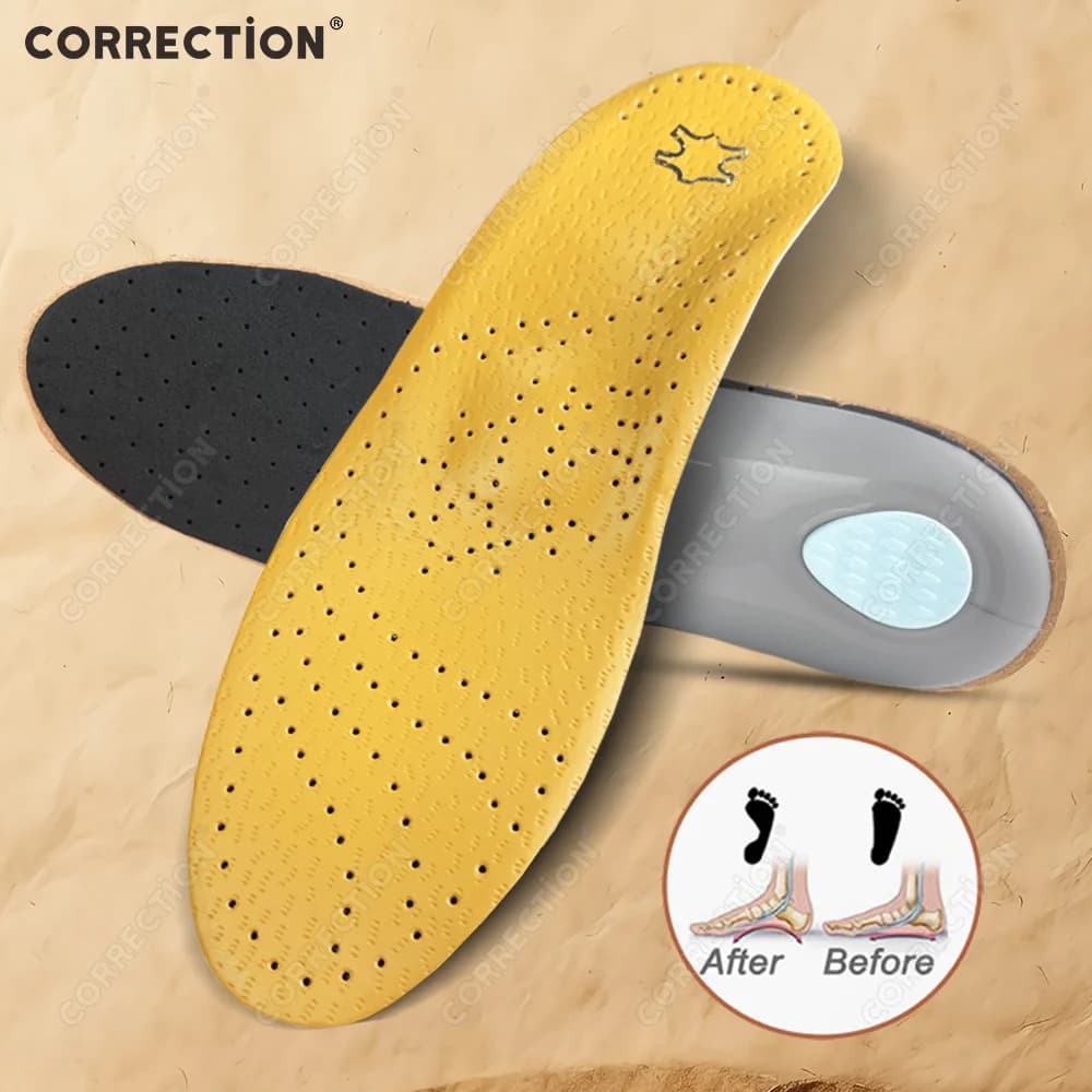 Leather Orthopedic Insole Arch Support Plantar Fasciitis Insoles Men Women O/X Leg Corrected Insoles Foot Care Products