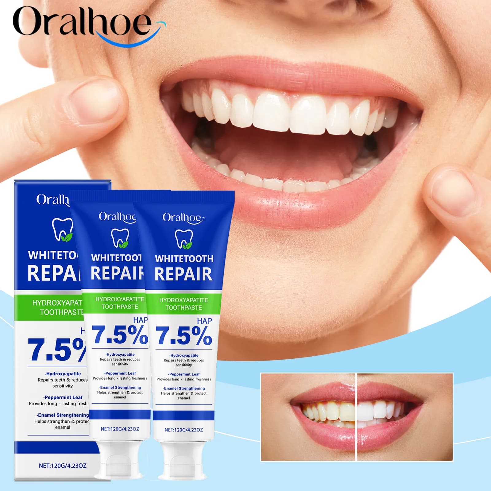 Oralhoe Nicotinamide White toothpaste Mint plaque prevention Removing stains Fresh breath Cleansing and tooth care