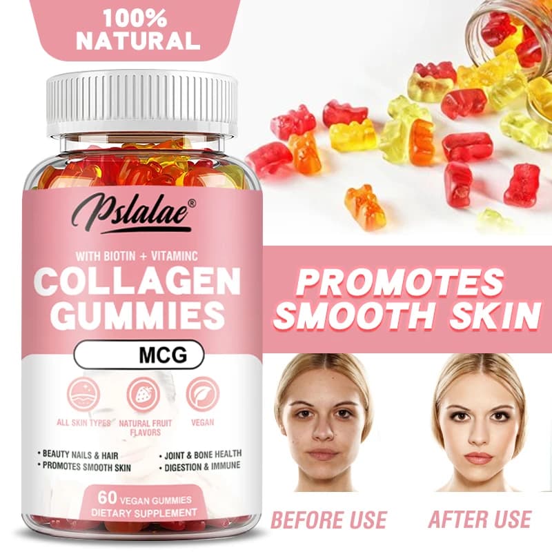 Collagen Gummies - Improve Dull Skin Tone, Promotes Collagen Production, Support Nails, Hair and Bone Health, Improves Vitality