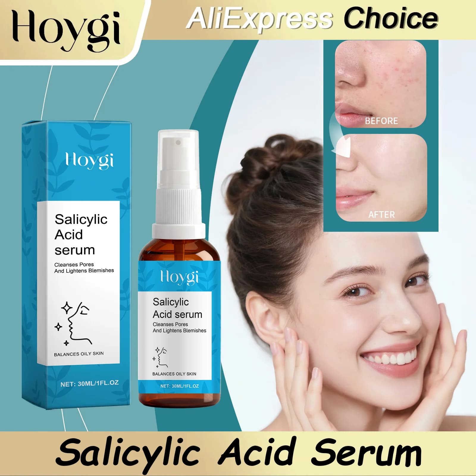 HOYGI Spray Serum Viso Anti-Acne to the Salicylic Acid, Hydrating and Repairer, Watch the Acne Macchies, Facial Essence, Shrink the Pores, Sebum Control