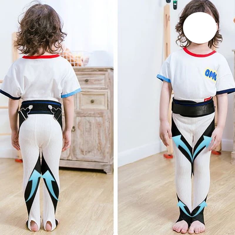 1 Set Cintura per la correzione della forma della gamba per bambini O/X, correttore posturale per raddrizzare il valgo del ginocchio annodato regolabile per uomini e donne