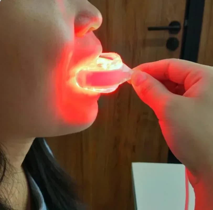 Starlite Smile Gum Disease Treatment, Periodontal Treatment Oral Care Red Light Therapy Promotes Healing and Pain Relief