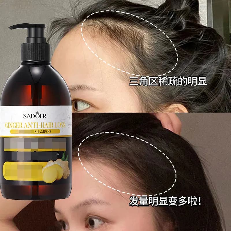 SADOER Shampoo per la crescita dei capelli allo zenzero, controllo dell'olio vegetale, antiforfora, shampoo anticaduta