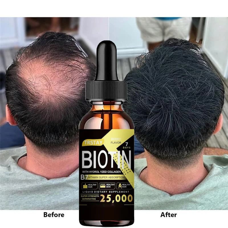 Essential oil for hair growth strengthens hair roots Anti hair loss care essential oils for head care for men appliances for Styling