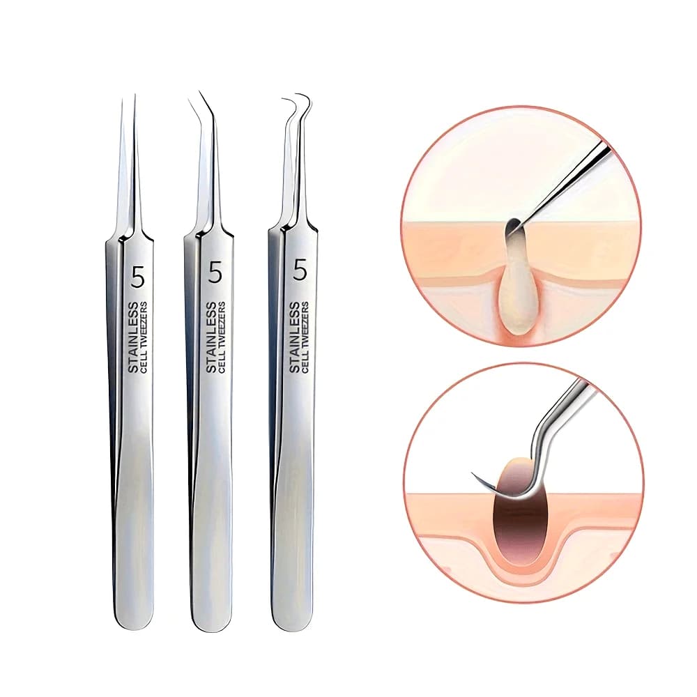 Needles kit for black dots and 1/3-piece Acne precision comedon extractors with tweezers, delicate beauty facial care tools