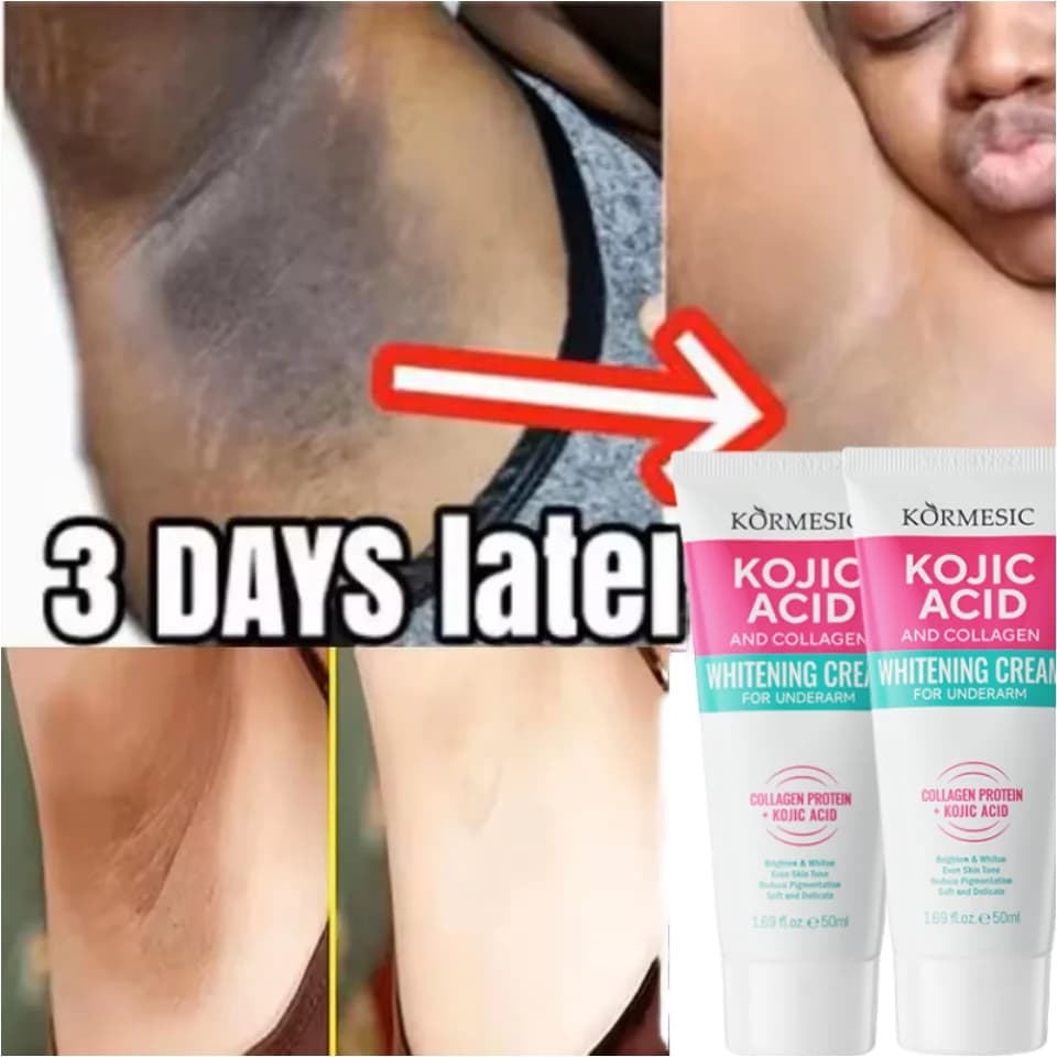 50g Corpo Ascelle Crema Sbiancante Parti Private Sbiancamento Sbiancare Glutei Ginocchio Illuminare Interno Coscia Intimo Scuro Rimuovere La Melanina
