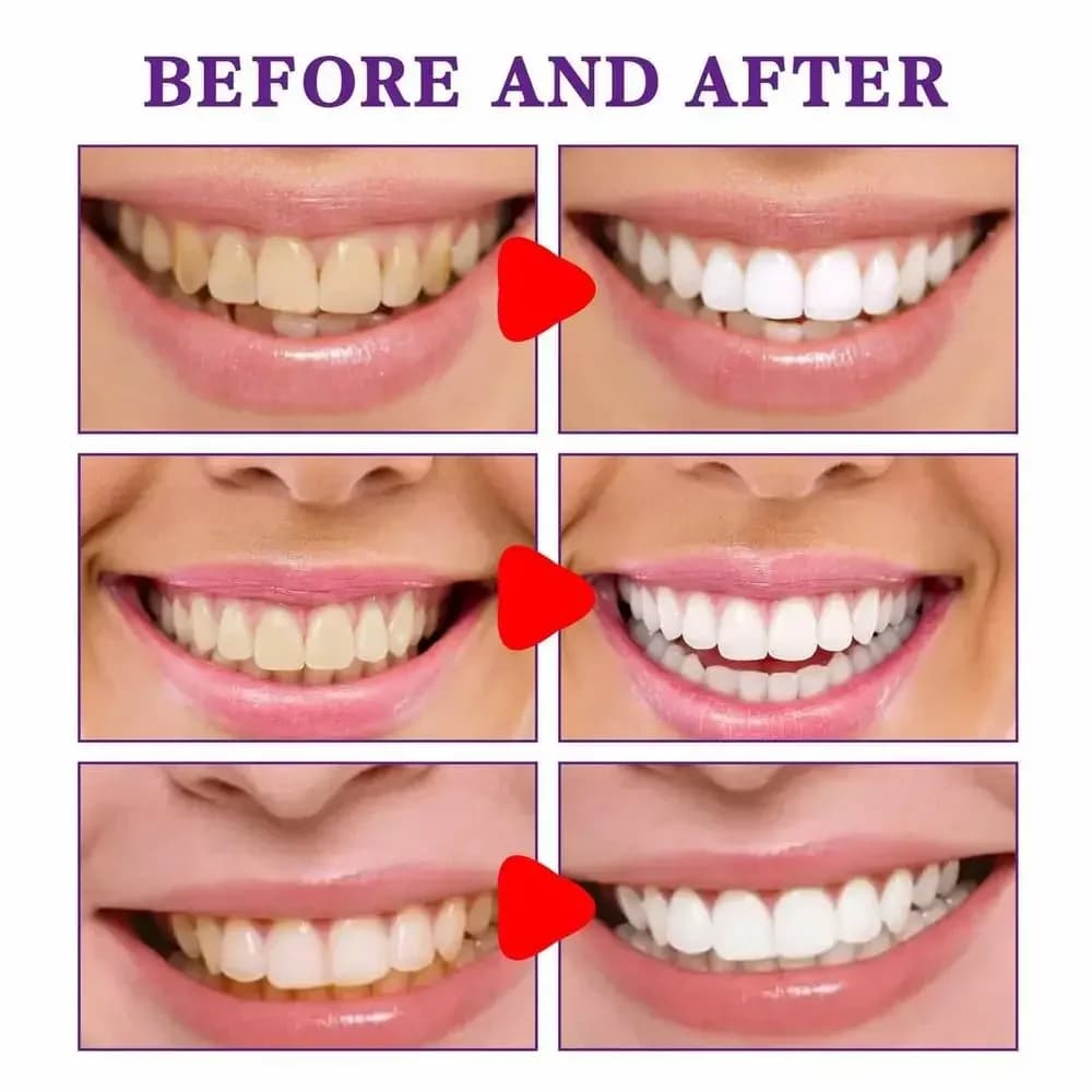 drop ship Teeth whitening kit for home use with led light Oral hygiene Teeth whitening gel wholesale