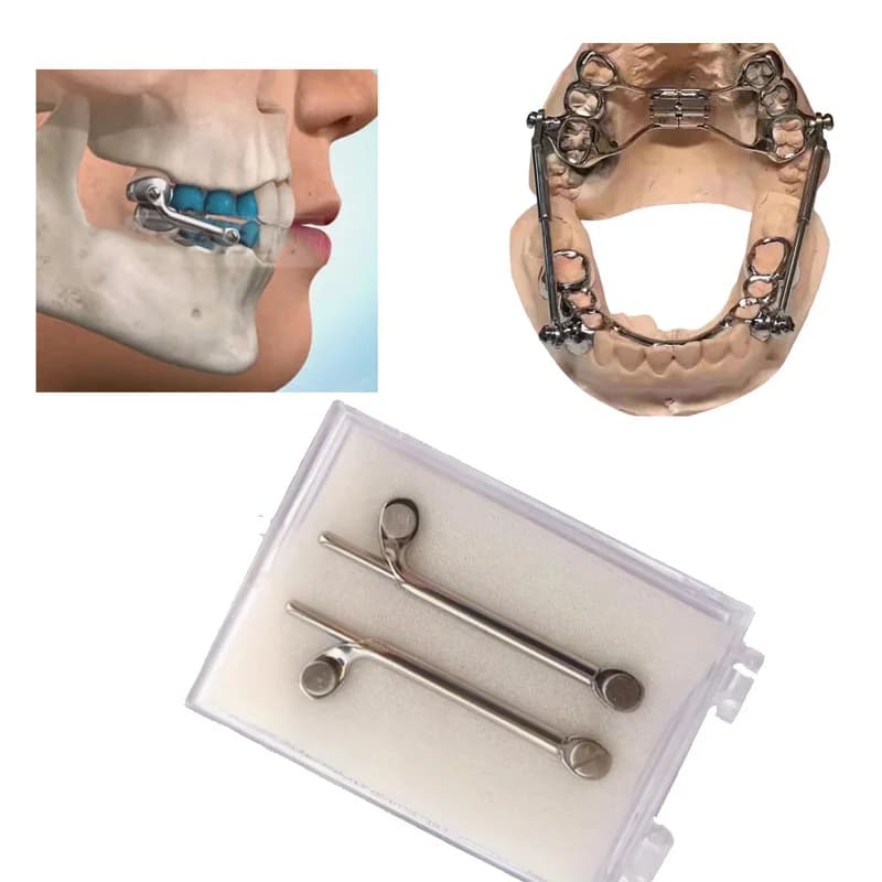 1 Set Set di apparecchi per erbri dentali Dentaurum Vite a esagono incassato Correzioni ortodontiche telescopiche di classe II