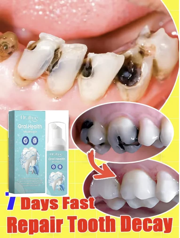 Oralhoe 60ml Mousse Detergente per Denti, Schiuma Dentifricia per Rimuovere le Macchie Gialle, Salute Orale, Alito Fresco, Sbiancante per Denti