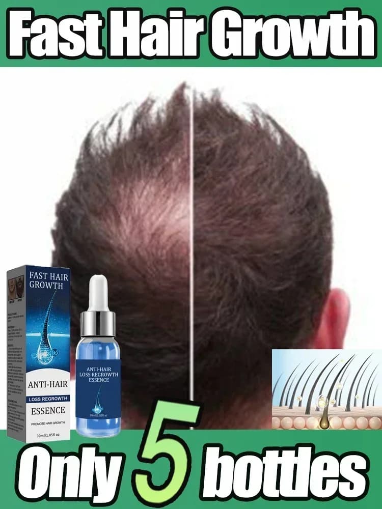 Hair Growth Essential Treatment for Regrowth of Loss Strengthens Hair Nuts Lightweight Leather Not Fat Improves scalp circulation