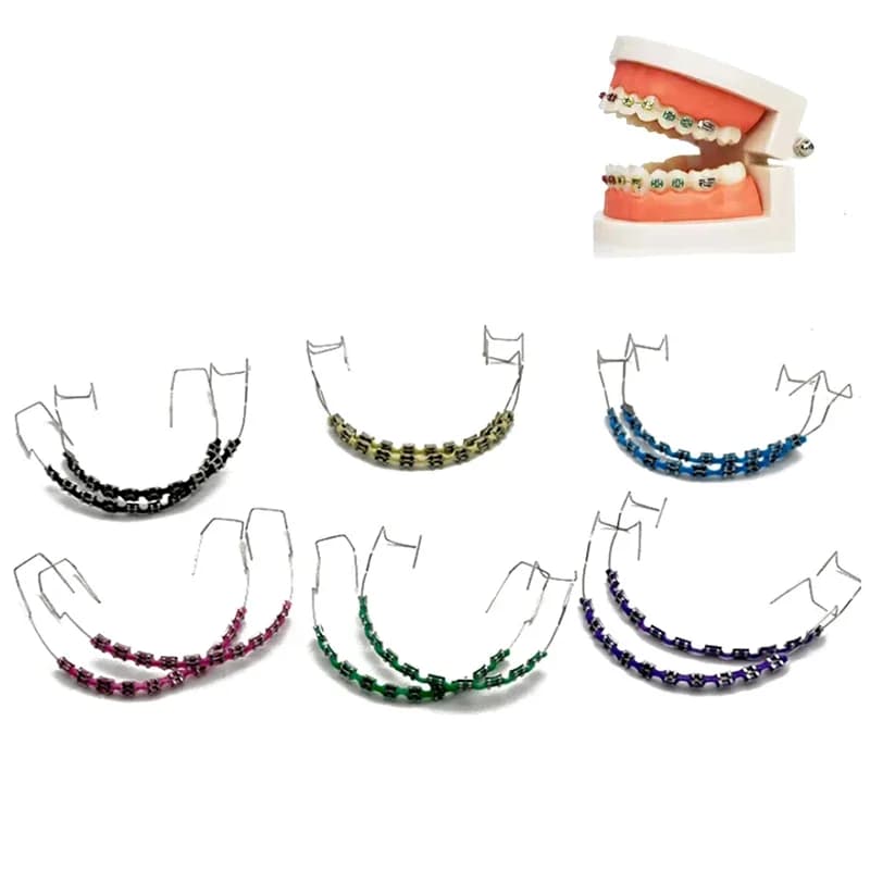1 Paio di Apparecchi Ortodontici Colorati con Fili Metallici, Supporti in Metallo e Legature Ortodontiche CK1160-LJX