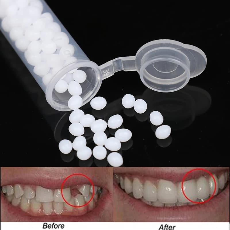 New Temporary Dental Repair Kit 1Box, Solid Collar for Tooths and Spaces, Beauty Tool for Tooths, Wall decal for Protected, Dental Whitening