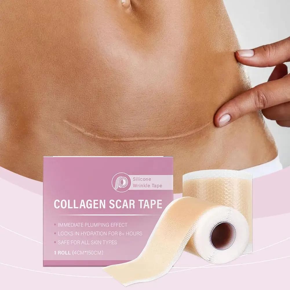 1 sheet roll for silicone scars, self-adhesive tape for scar cover from 4 cm x 150 cm, reusable and effective strips for skin care, ribbon for collagen scars