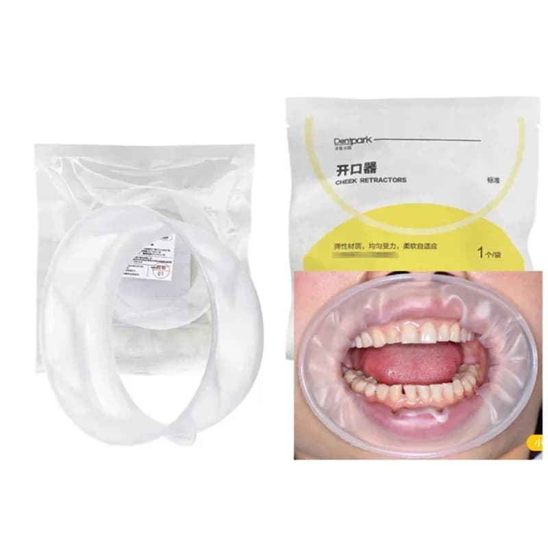 20Pcs Dentpark O-Shape Oral Cheek Retractor Disposable Elastic Mouth Opener Dental Clinic Orthodontic Teeth Whitening Consumable