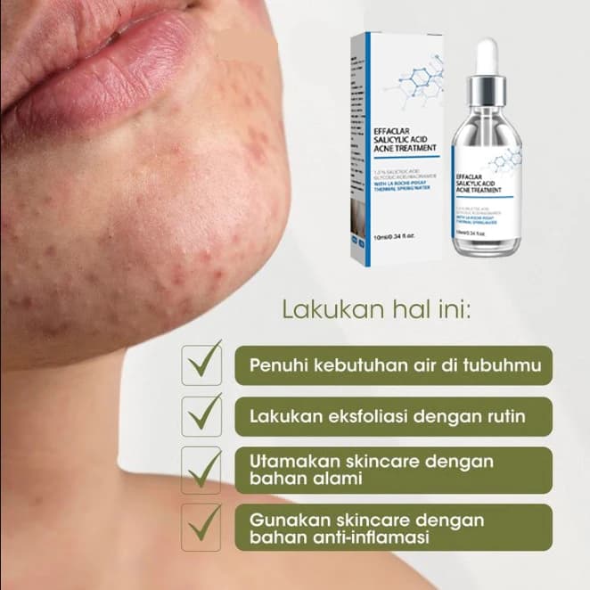 Antiacne facial Essence, acne removal and skin smoothing, collagen protein, essential oil of hyaluronic acid, skin care cosmetics