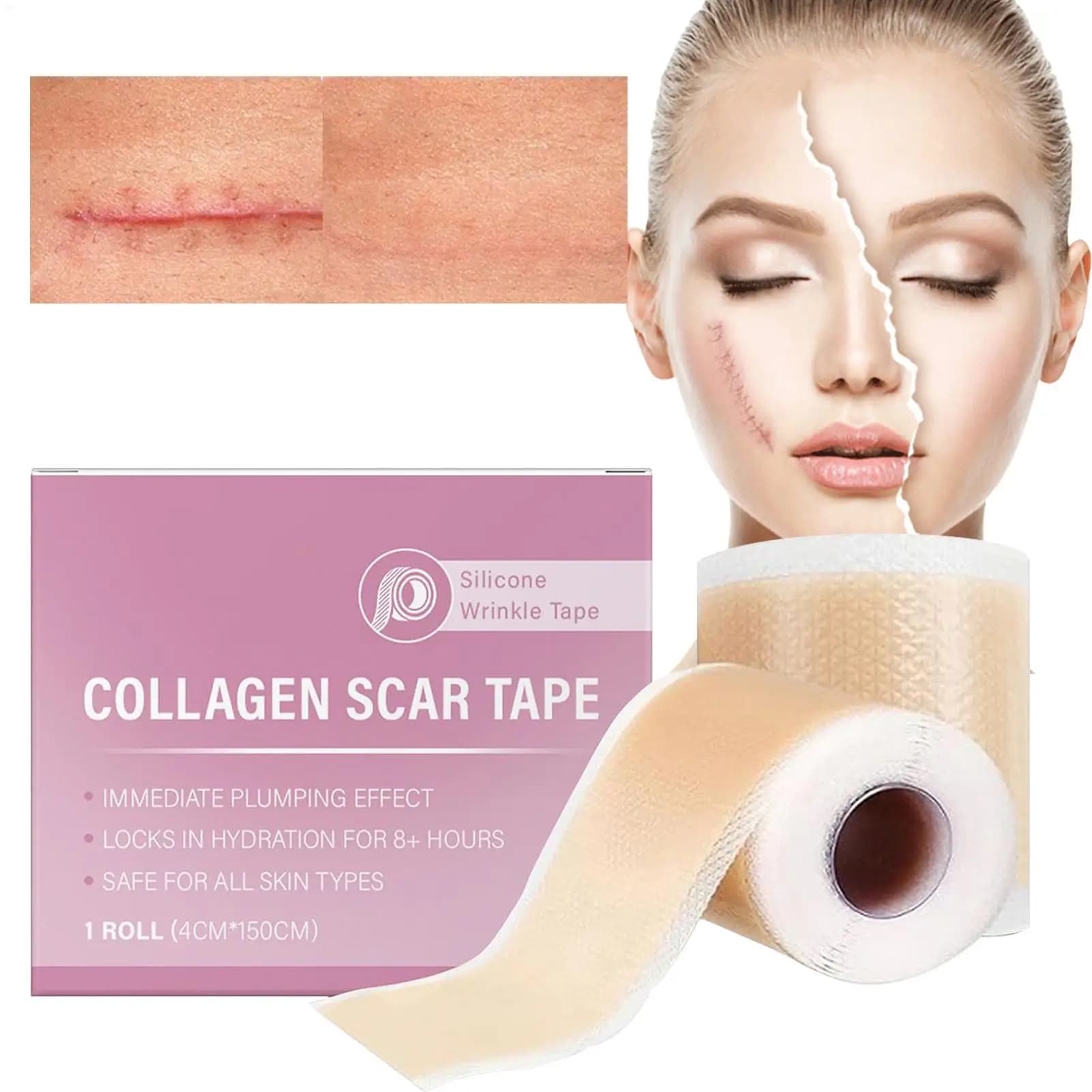 1 sheet roll for silicone scars 4 cm x 150 cm Self-adhesive tape for scar cover Reusable and effective strips for skin care Collagen scar tape
