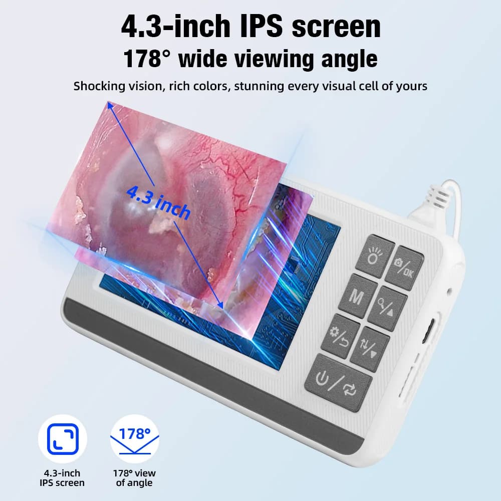 KERUI 3.9mm Otoscopio Orecchio Endoscopio Fotocamera con 6 Luci Schermo da 4.3 Pollici Strumento per la rimozione del cerume Earpicker per Bambini Adulti P60