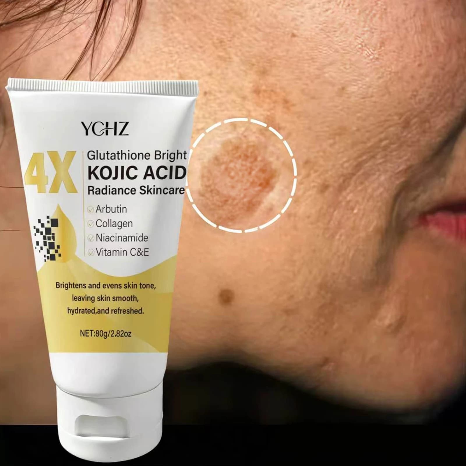 Kojico acid face cream uniforms skin tone, eliminates dark spots and matte effect - Not greasy, suitable for both men and women - Whitening and moisturizing cream, for use day and night