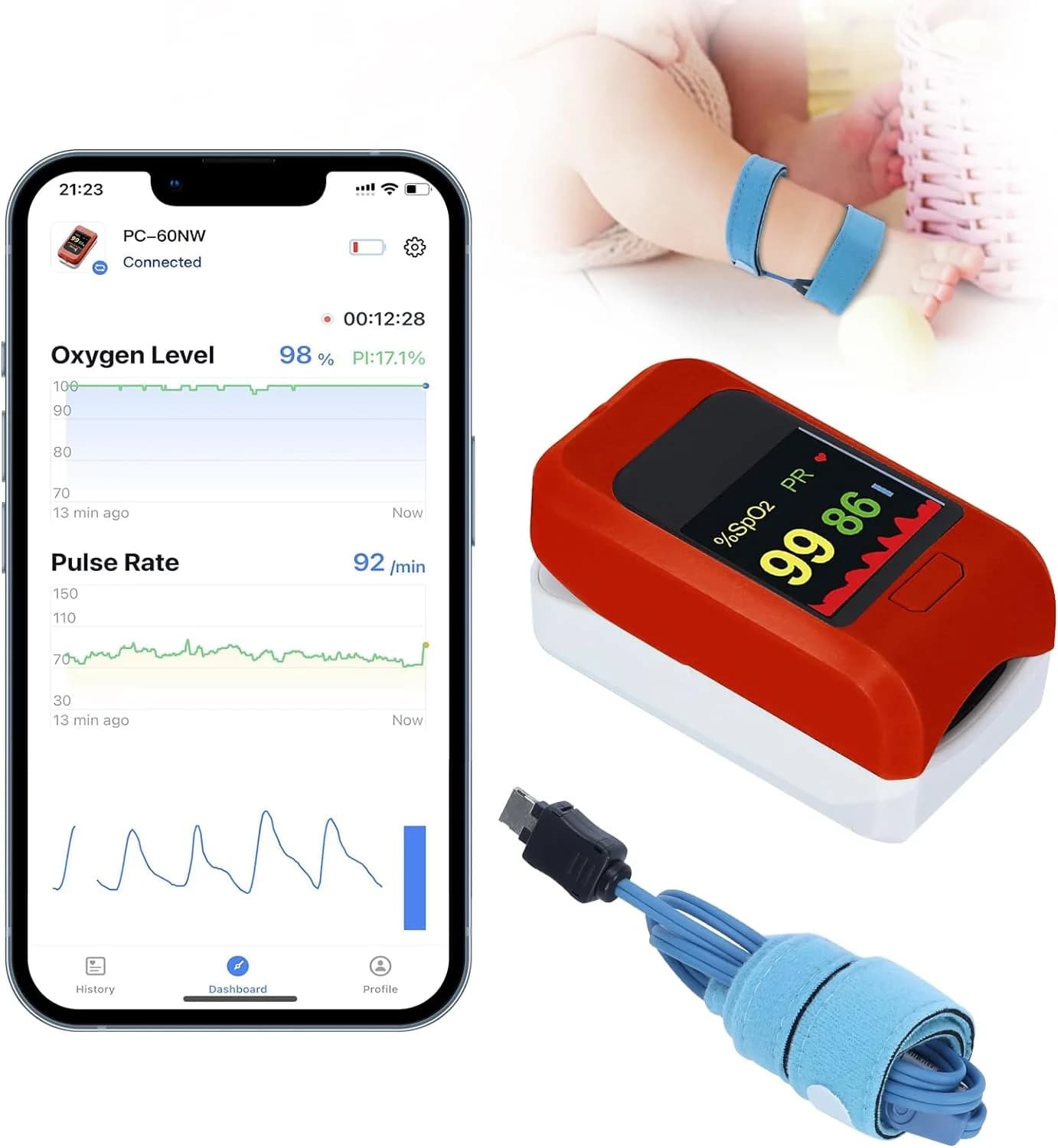 Viatom PC60NW Monitor for Children's Oxygen with App Bluetooth Tracks Children's Heart Rate Oxygen Level Monitor for Baby Sleep Pulsossimeter