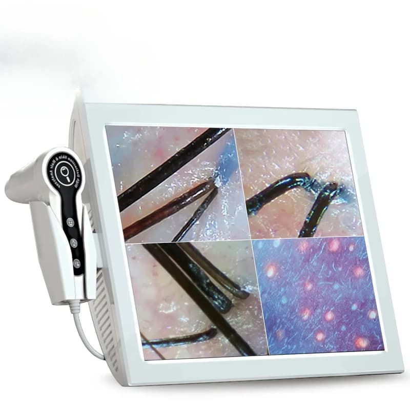 Analizzatore della pelle del rilevatore del cuoio capelluto dei punti neri della lente d'ingrandimento del tester del microscopio dello scanner del viso LCD ad alta definizione
