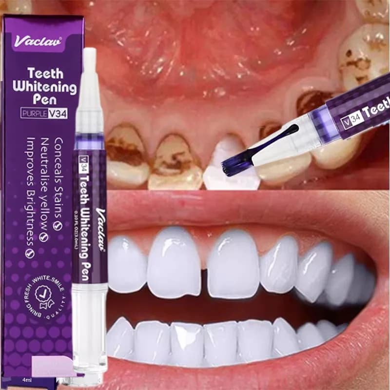 Penna sbiancante per denti V34, dentifricio per rimuovere placca e macchie, igiene orale, sbiancamento dentale, strumenti per l'alito fresco e la cura dei denti