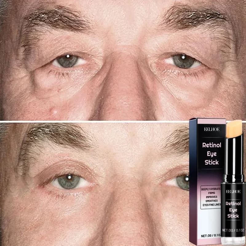 Cream for Instant Removal of Eye Bags Collagen Anti-wrinkles Dissolvency Thin Lines Skin Thickening Anti Eyebrows Inflator Illuminate Eye Care