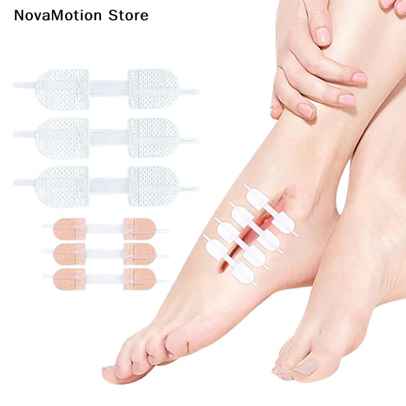[NM]3Pcs Zipper Tie Wound Closure Patch Hemostatic Patch Wound Fast Suture Zipper Band-Aid Outdoor Portable Skin Care[NM]