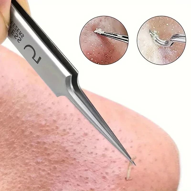 1 pezzo extra fine n. 5 pinzette per punti neri per acne cellulari - Bellezza del viso Rimuovi strumenti per aghi per l'acne per lo strumento per la cura della pelle