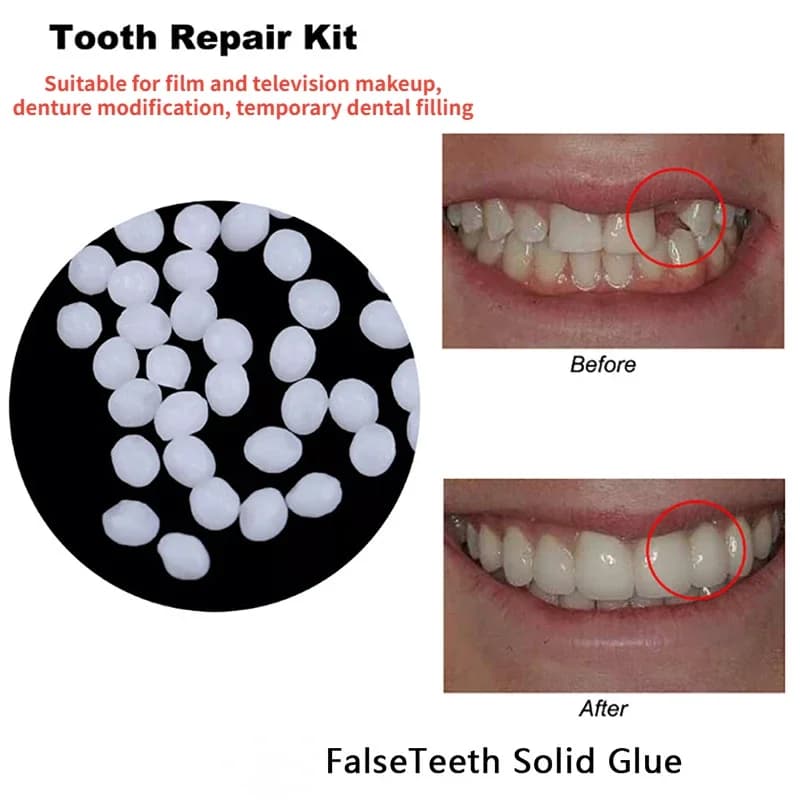 Colla per riparazione dei denti Lacune temporanee modellabili Mancante Riempimento rotto Adesivo solido per denti finti Sbiancamento Sicurezza Forniture dentali Nuovo