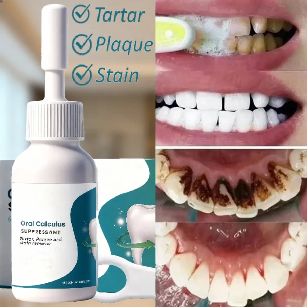 2025 hot alica Oral plate inhibitor ьAdsorbs Bad Breath Remove yellow teeth Strong teeth cleaning Macchie logioOral Care