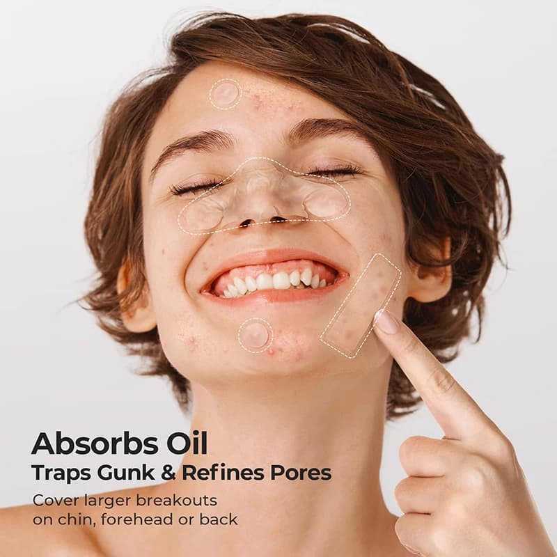 364 Pz Removal Brufolo Invisibile Patch Anti-Acne Macchie Signs Corrector Sticker Repair Tool Beauty Makeup