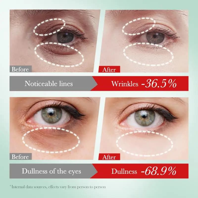 SADOER Crema Contorno Occhi alla Nicotinamide Anti Occhiaie e Borse, Idratante, Cosmetico Coreano per la Cura della Pelle
