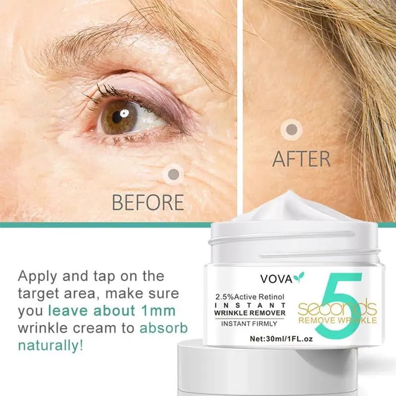 Crema Contorno Occhi al Retinolo e Collagene, Rassodante, Idratante, Effetto Lifting, Migliora l'Edema, Idrata la Pelle, Rassodamento Istantaneo
