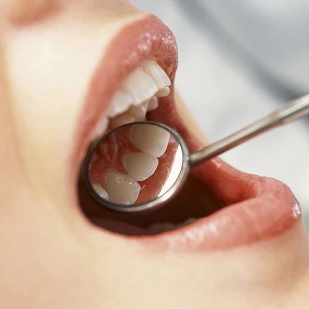 Universal Stainless Steel Dental Mirror for Tartarus and Plate Removal, IPX8 Waterproof Oral Reflector, Whitening Tool