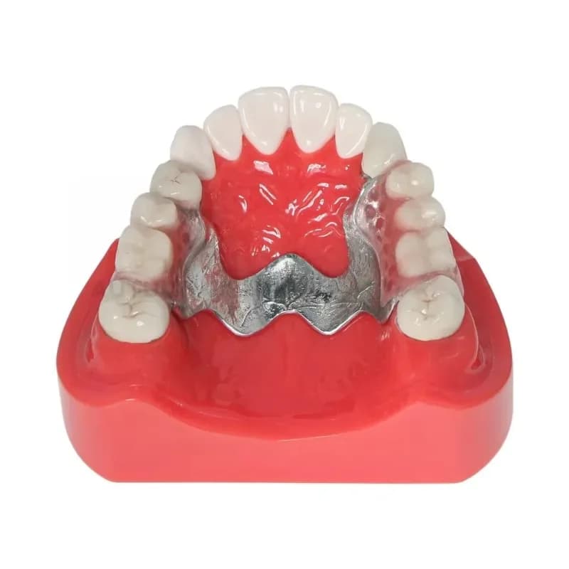 Modello di Telescopio Dentale per Corone | Protesi Rimovibile per Dimostrazione, Ausili Didattici Dentali | Corona in Zirconia/Cromo-Cobalto