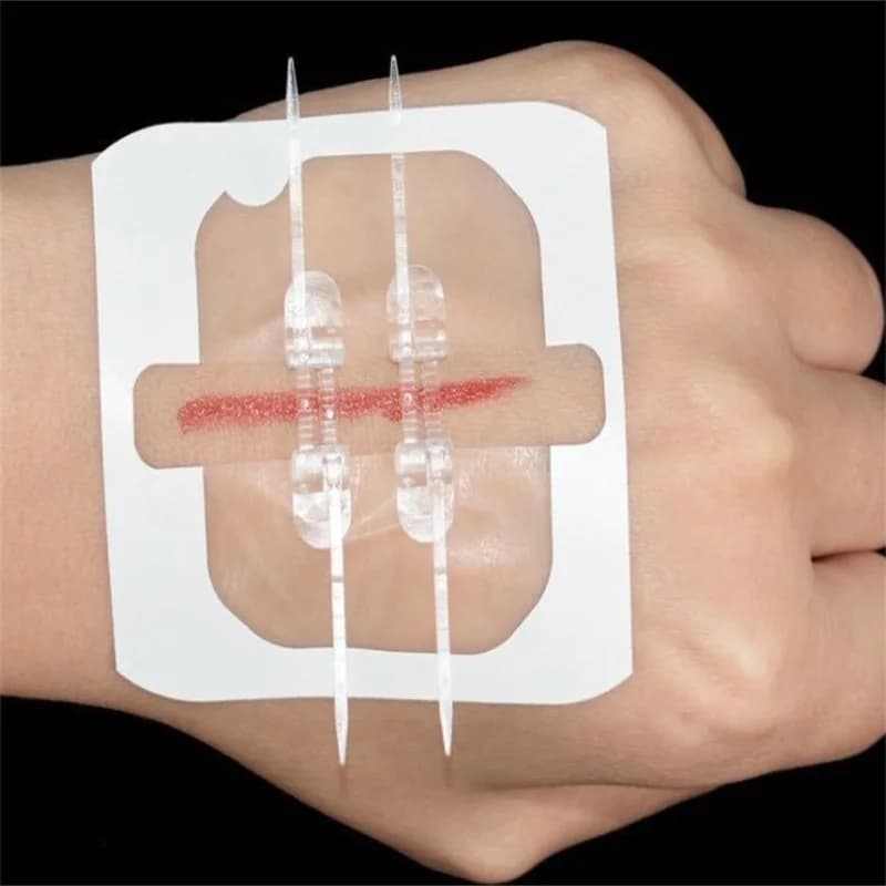 Chiusura della ferita di emergenza Punto con zip Sutura Cerotti Riparazione ferite senza punti per attività all'aperto Ferita rapida con coagulo