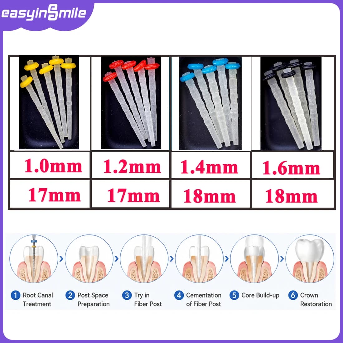Dental Fibre Pile Fibre Pile 20 Posts + 4 Drills Dental Products Fiber Post Drill Screw Thread Quartz Mixed Size Kit Easyinsmile