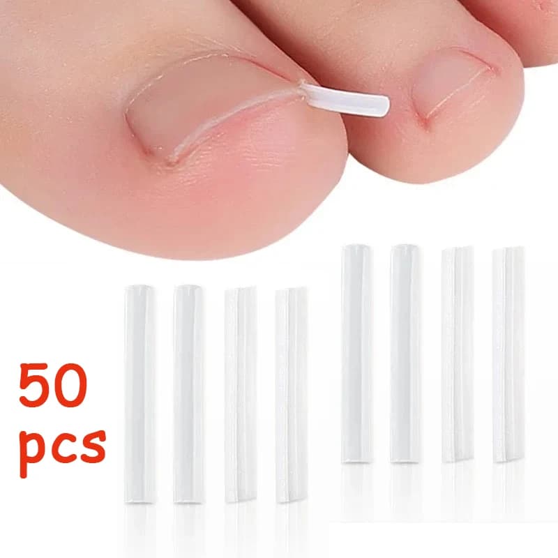 50 Pezzi Strumento di Correzione per Unghie Incarnite, Pad Trattamento Invisibile per Unghie Incarnite, Clip Raddrizzante per Scanalature, Attrezzo per la Cura dei Piedi