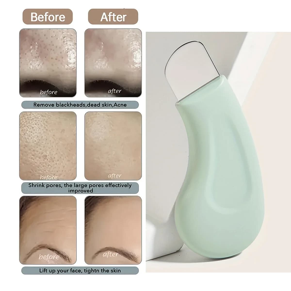 Kit di Rimozione Punti Neri e Bianchi, Strumento per Pulizia Pori del Naso e del Viso, Estrattore per Comedoni e Acne, Strumenti per la Cura della Pelle per Donne e Uomini