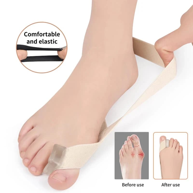 1-4 Pezzi Correttore per Alluce Valgo, Tutore Ortopedico per Hallux Valgus, Comodo e Traspirante per Supporto Giorno/Notte