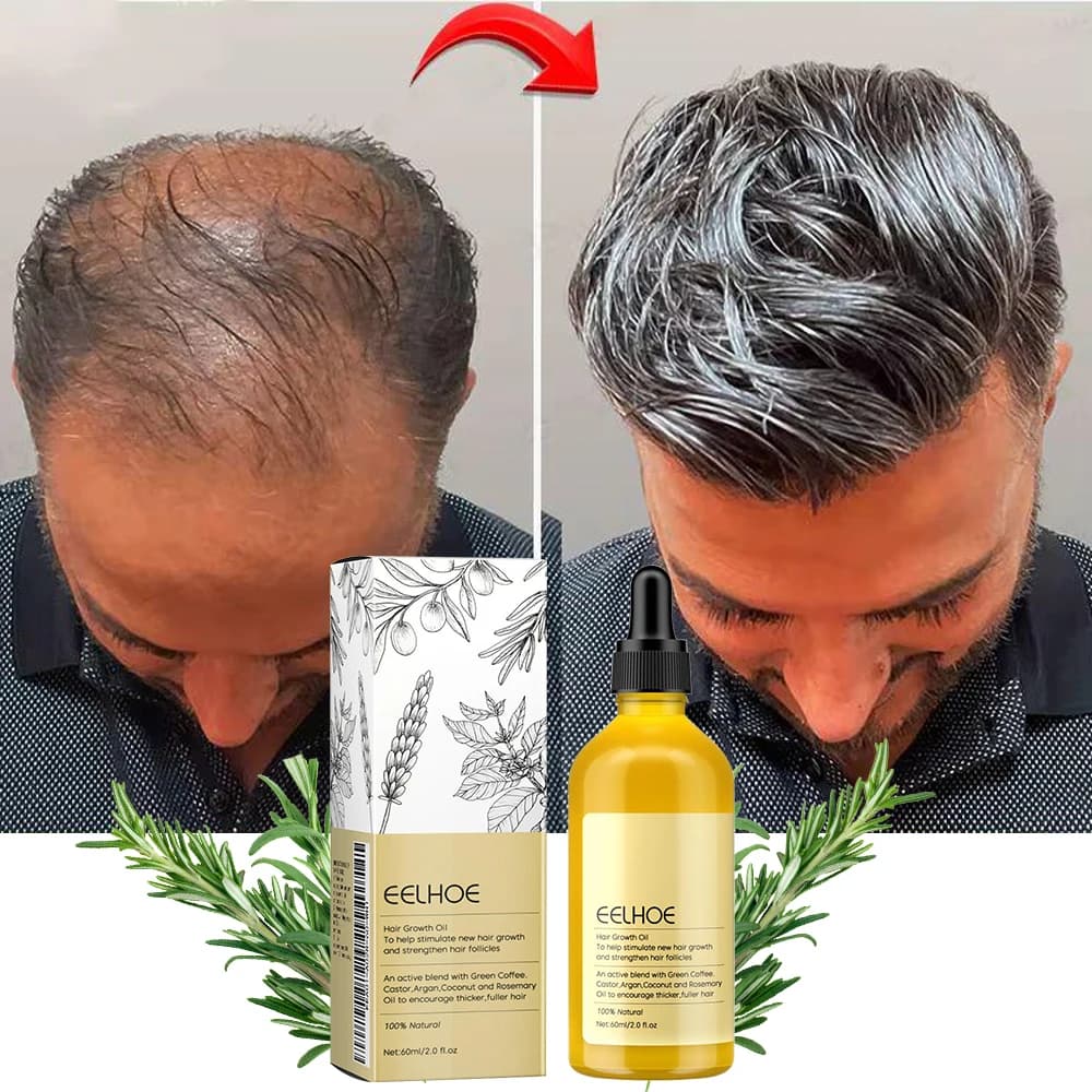 Olio essenziale di rosmarino per capelli spessi, 1 pezzo di lavanda vegana, ripara i danni ai capelli, previene la caduta dei capelli, ammorbidire i capelli