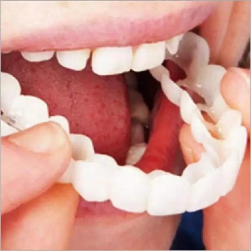 Bestseller: Copertura Dentale Sbiancante in Silicone, Faccette per Denti Superiore, Strumento di Bellezza Cosmetico CK848-FRO